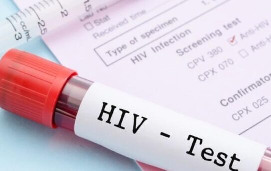 E' possibile contrarre l'AIDS con rapporti orali non protetti?